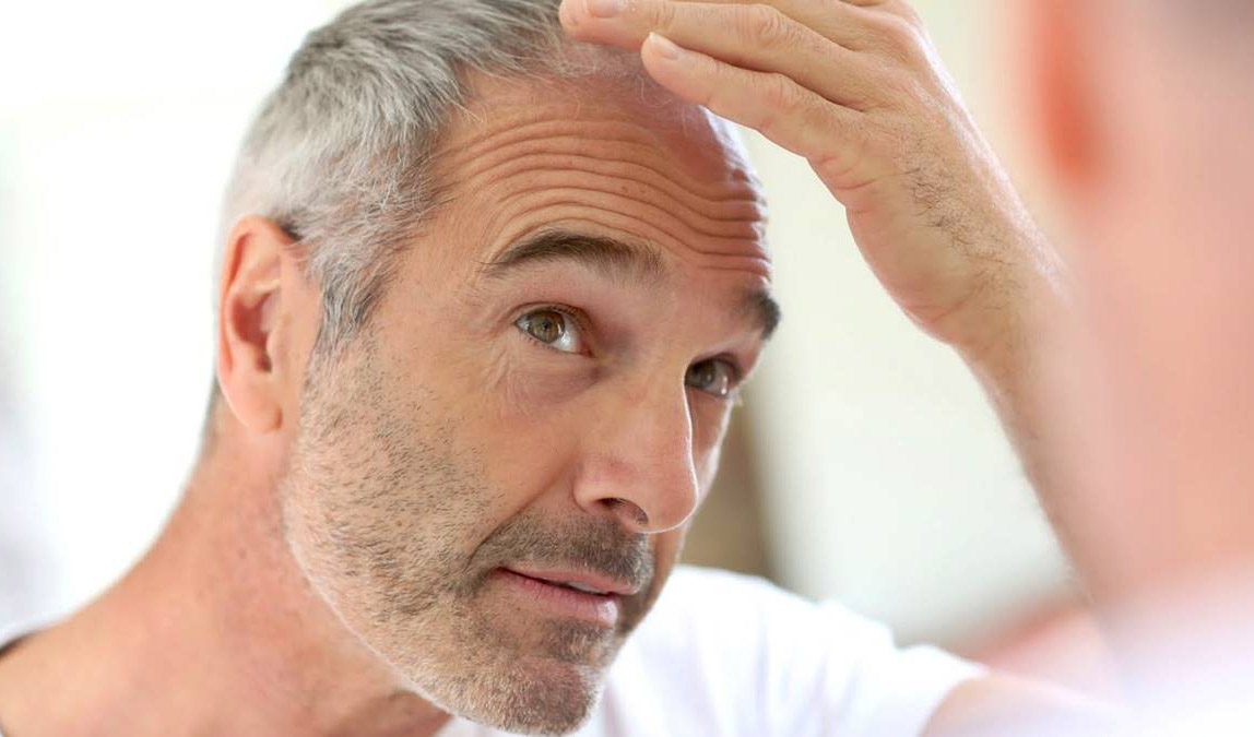The Facts About Hair Loss In Men the-facts-about-hair-loss-in-men