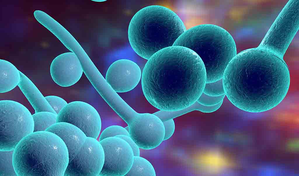 Candida Non Passa Candida Albicans Sympt mes Causes Et Traitements Candida Non Passa Candida Albicans Sympt mes Causes Et Traitements